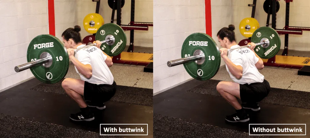 屁股眨眼有那麼嚴重嗎？